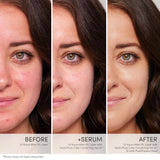 jane iredale - HydroPure Color Correcting Serum - Farbkorrektur-Serum - jane iredale Mineral Make-up - ZEITWUNDER Onlineshop - Kosmetik online kaufen