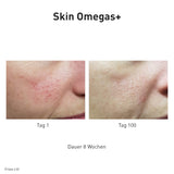 Advanced Nutrition Programme - Skin Omegas+ - Nahrungsergänzung - Advanced Nutrition Programme - ZEITWUNDER Onlineshop - Kosmetik online kaufen