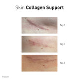 Advanced Nutrition Programme - Skin Collagen Support - Nahrungsergänzung - Advanced Nutrition Programme - ZEITWUNDER Onlineshop - Kosmetik online kaufen