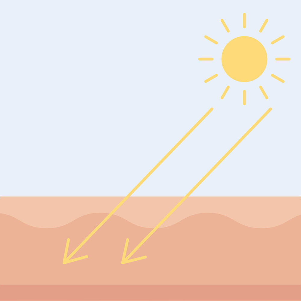 Eine schematische Abbildung der Sonne und der Einwirkung von Sonnenstrahlen auf die oberen Hautschichten, wenn auf diesen keine Sonnenschutzprodukte aufgetragen wurden