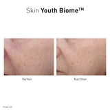 Advanced Nutrition Programme - Skin Youth Biome - Limited Edition - Nahrungsergänzung - Advanced Nutrition Programme - ZEITWUNDER Onlineshop - Kosmetik online kaufen
