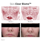 Advanced Nutrition Programme - Skin Clear Biome - Nahrungsergänzung - Advanced Nutrition Programme - ZEITWUNDER Onlineshop - Kosmetik online kaufen